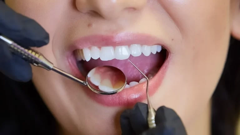 Advantages of Long-Term Relationships with a Private Dentist in Manchester