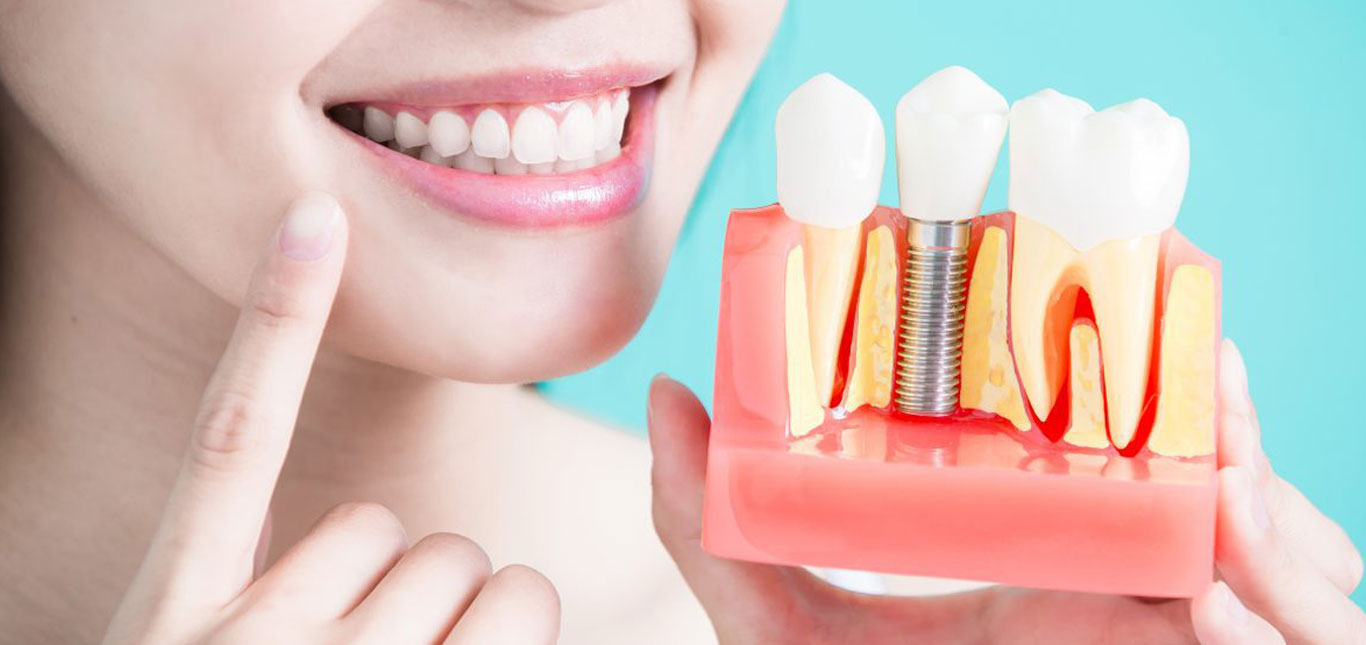 Innovative Dental Implant Solutions at Sheen Dental Implants Richmond