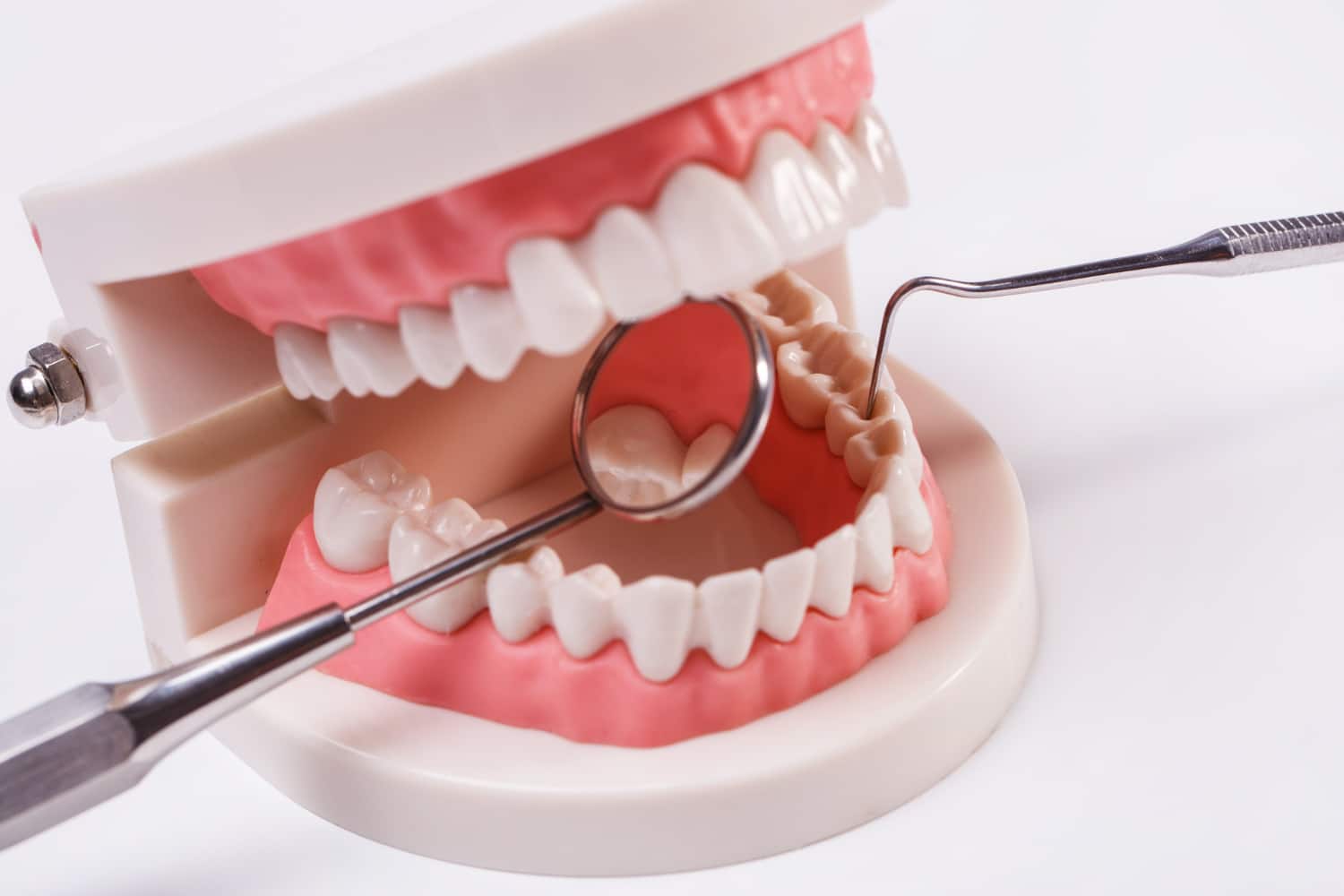 Dentist Supports